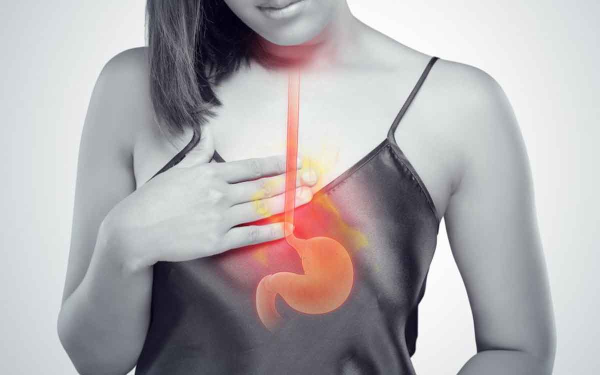 Acid Reflux | యాసిడ్ రిఫ్ల‌క్స్ ఉన్న‌వారు ఈ చిట్కాల‌ను పాటిస్తే ఎంతో ఉప‌శ‌మ‌నం పొంద‌వ‌చ్చు