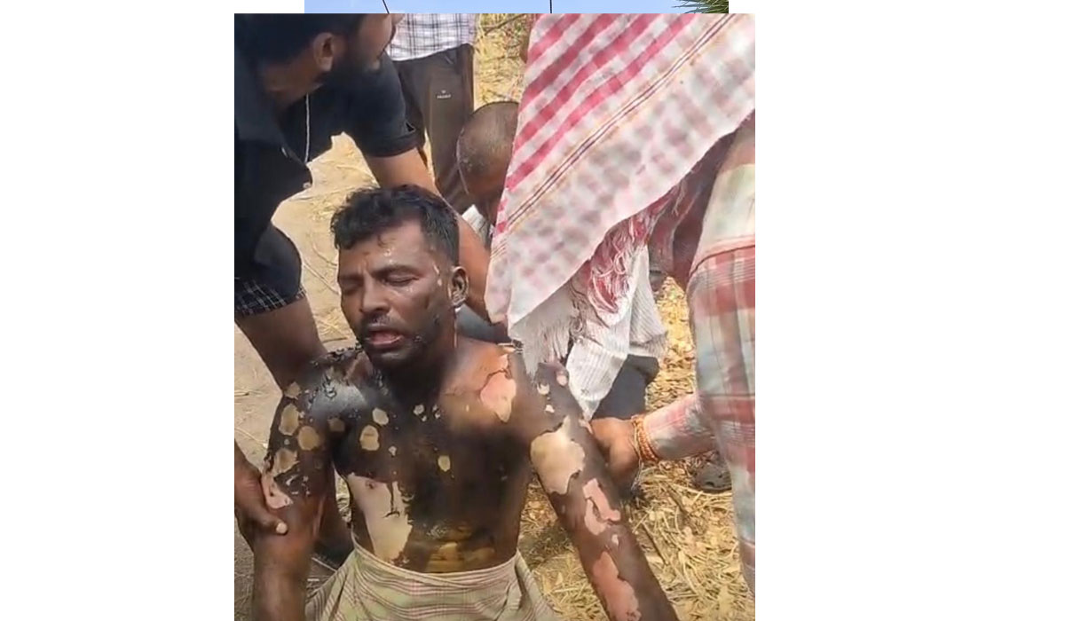 Transco | ట్రాన్స్‌కో సిబ్బంది నిర్లక్ష్యం.. ట్రాన్స్ ఫార్మర్ మరమ్మతులు చేస్తుండగా విద్యుత్ సరఫరా