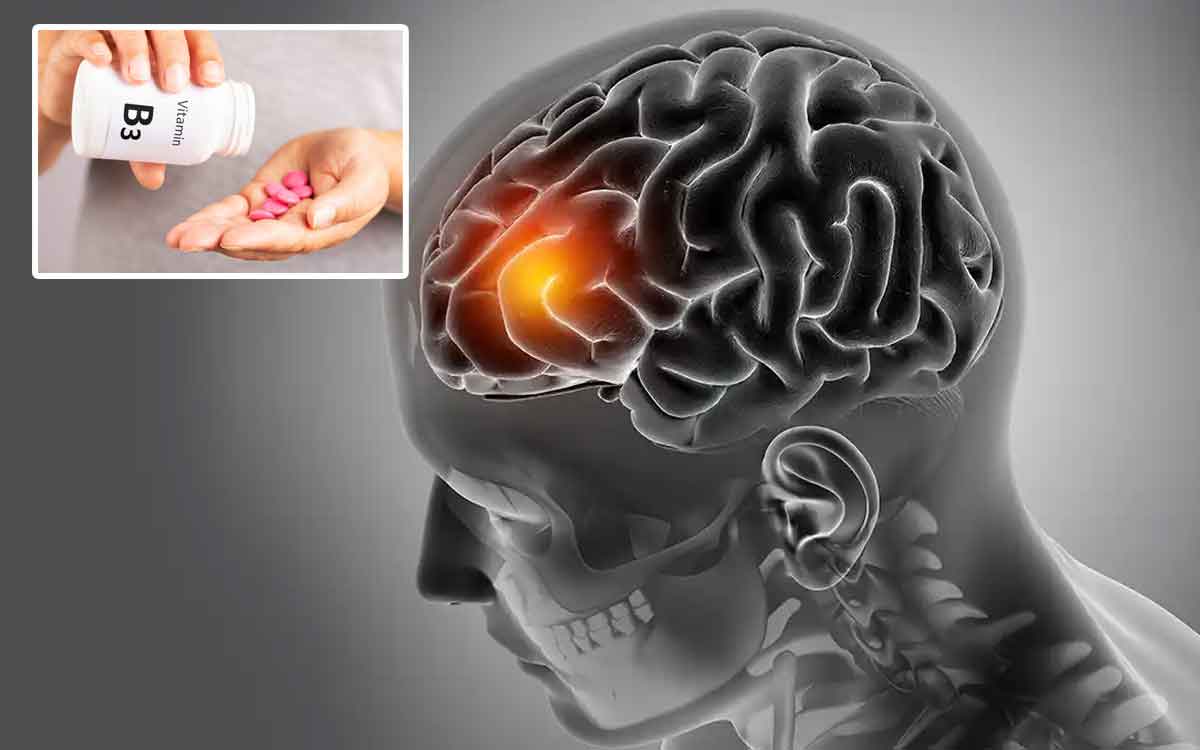Brain Cancer | మెద‌డు క్యాన్స‌ర్ చికిత్స‌కు ఎంతో దోహ‌దం చేస్తున్న విట‌మిన్ బి3.. సైంటిస్టుల అధ్య‌య‌నం..