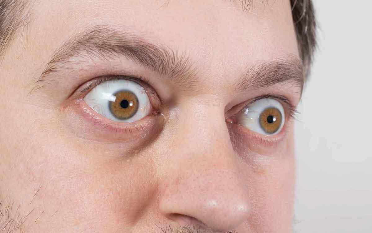 Eyes | క‌ళ్ల‌లో ఈ ల‌క్ష‌ణాలు క‌నిపిస్తున్నాయా.. అయితే అవి థైరాయిడ్ వ్యాధుల‌కు సంకేతం కావ‌చ్చు..