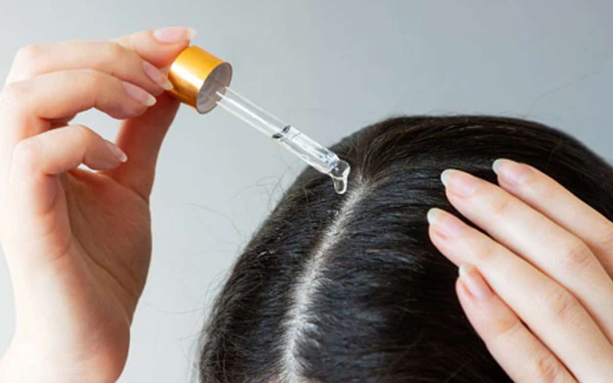 Hair Fall | జుట్టు రాలే స‌మ‌స్య‌కు అస‌లు కార‌ణాలు ఏంటి.. ఎలాంటి చ‌ర్య‌లు ప‌నిచేస్తాయి..