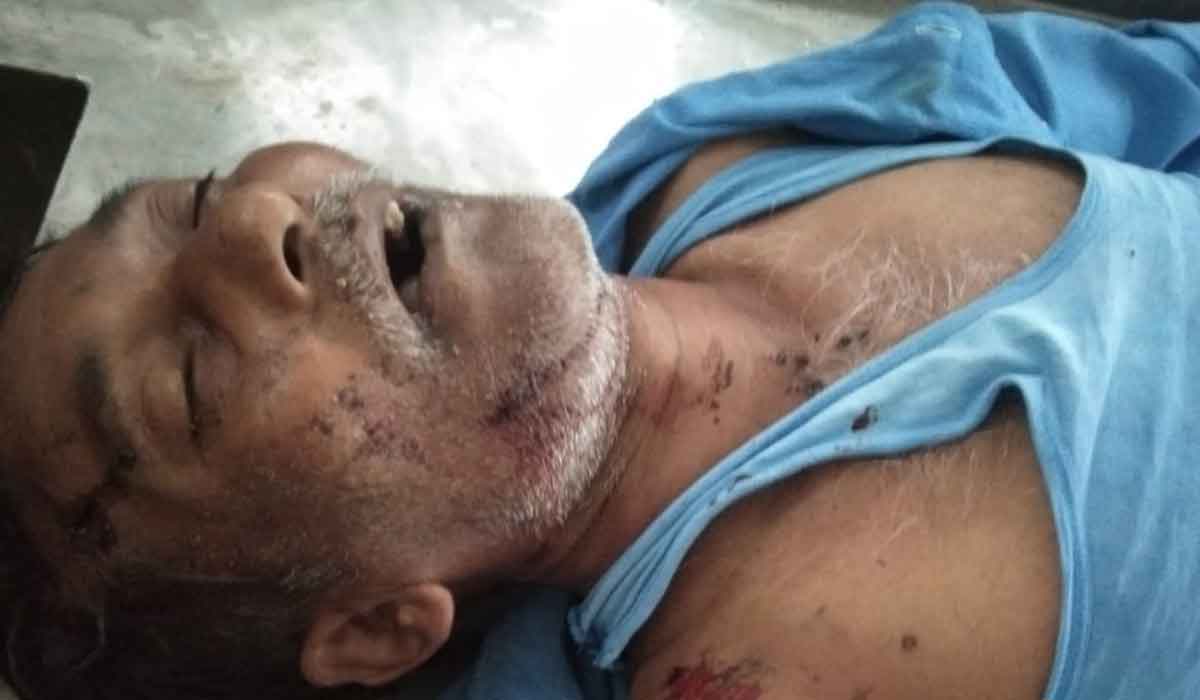 Road Accident | రోడ్డు ప్రమాదంలో అల్ట్రాటెక్ సిమెంట్ ఫ్యాక్టరీ కార్మికుడి దుర్మరణం