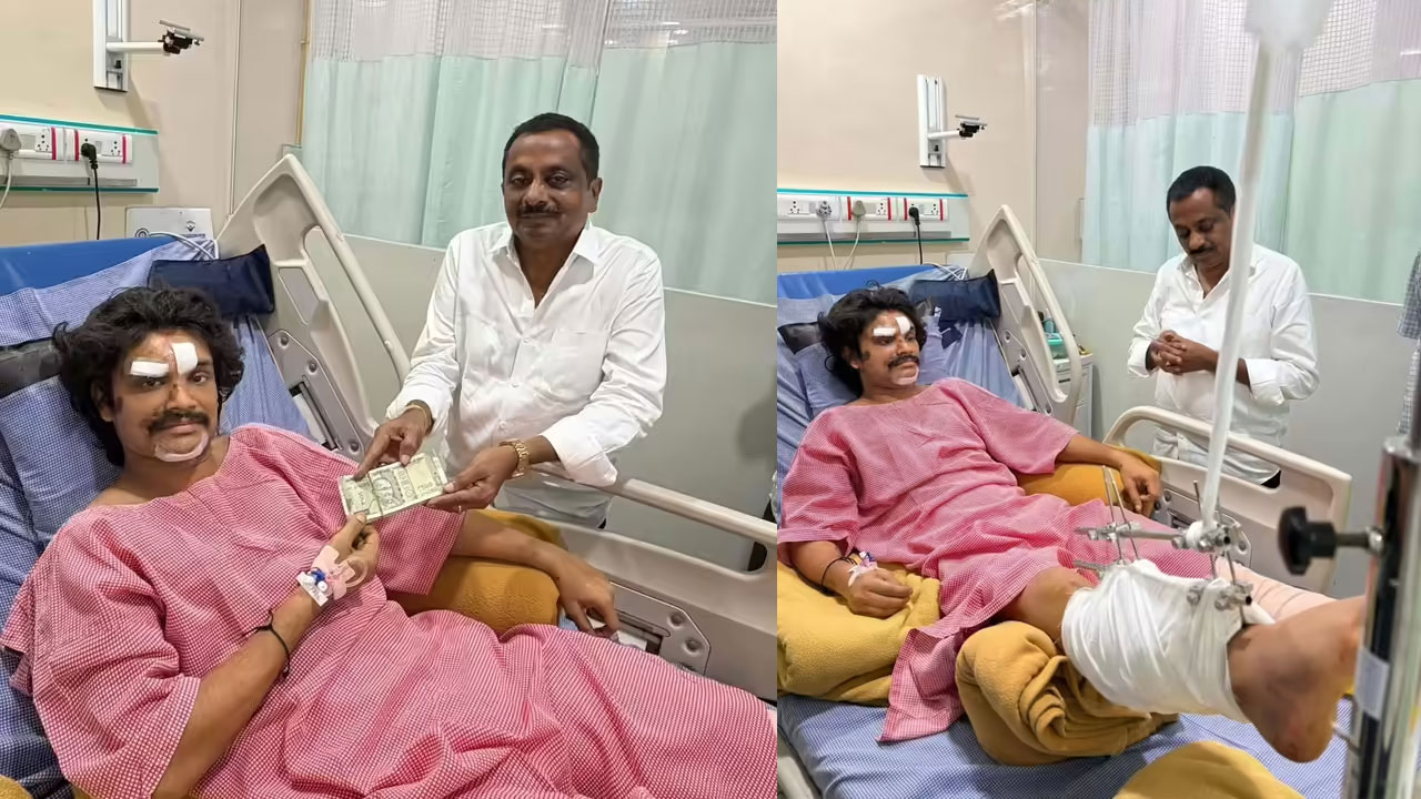 Pandu Master | ప్రమాదంలో గాయపడిన పండు మాస్టర్‌కు అండగా ప్రముఖులు.. మంత్రి సుభాష్ నుంచి ఆర్థిక సాయం