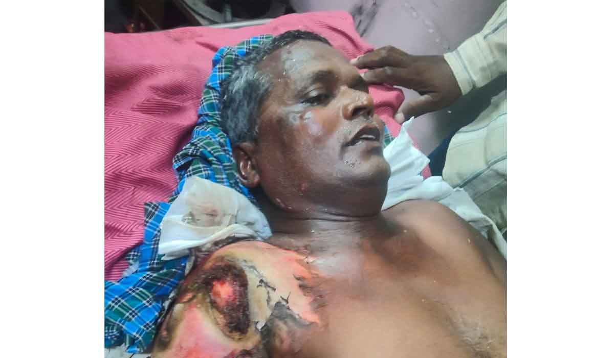 Electric Shock | ఫాజు‌ల్‌నగర్‌లో విద్యుత్ షాక్‌తో లైన్‌మెన్‌కు తీవ్ర గాయాలు