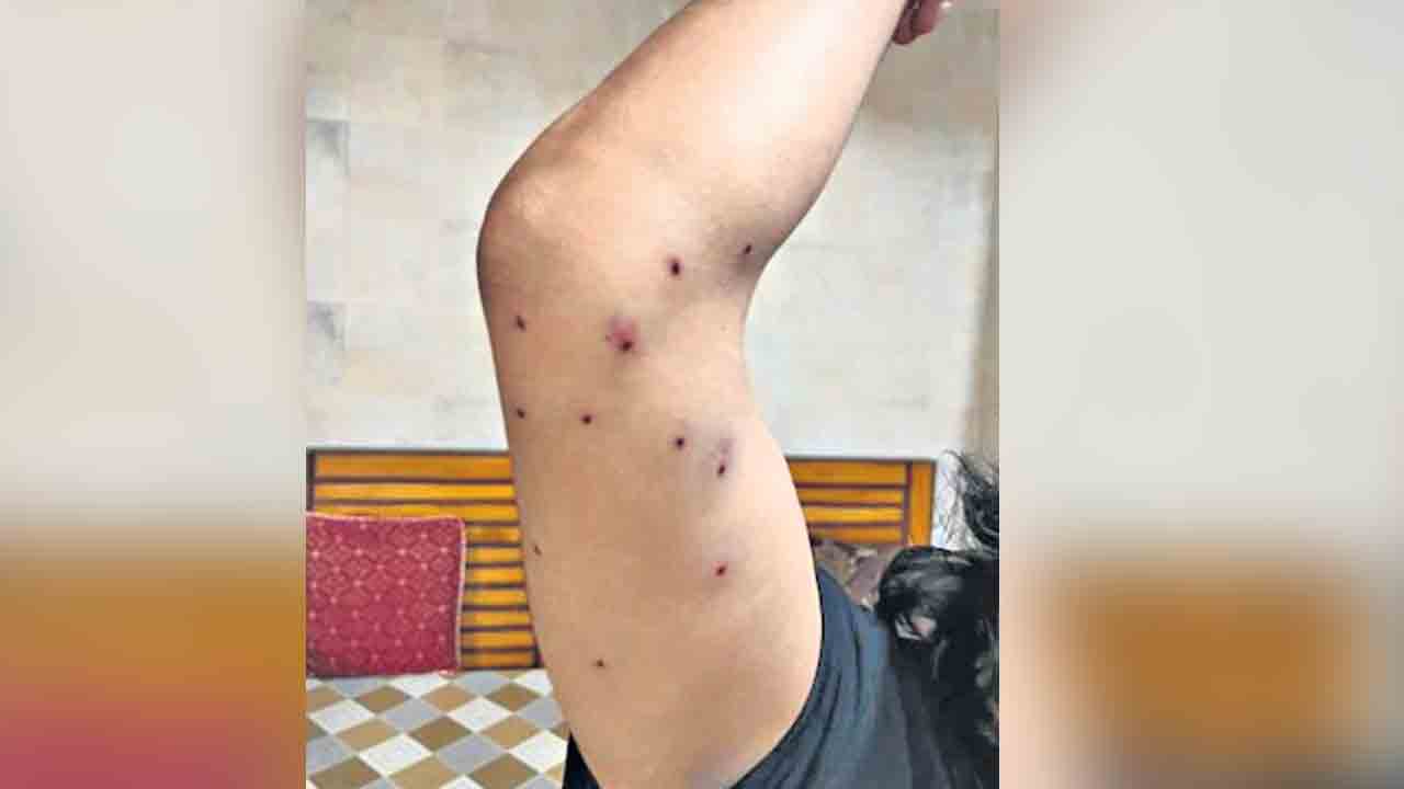 విద్యార్థులపై పెల్లెట్‌గన్స్‌తో దాడులు
