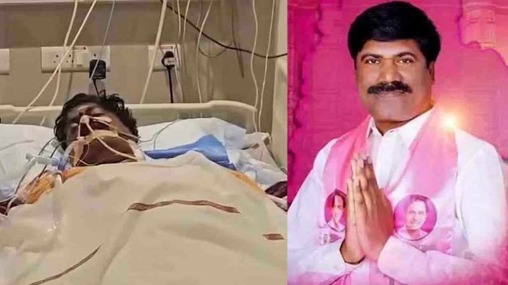 Peddi Sudarshan Reddy | ‘పెద్ది’కి మరోసారి న్యూరో టెస్ట్‌.. శబ్దాలు, స్పర్శకు స్పందన లేదు: యశోద హాస్పిటల్‌ సీఏవో