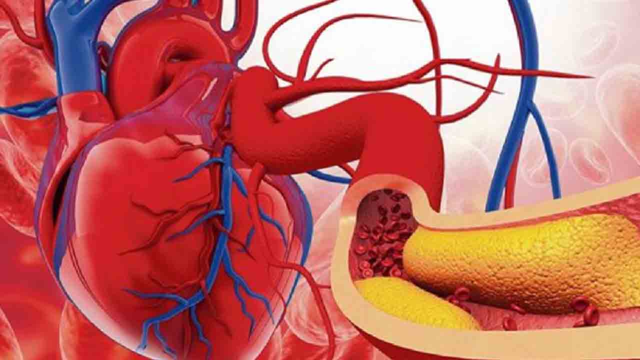 10లో 9మందికి చెడు కొలెస్ట్రాల్‌