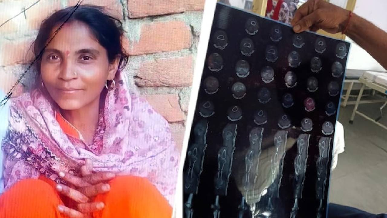 Haryana | కాలు విరిగిందని ఆస్పత్రిలో చేరిన మహిళకు హార్ట్ సర్జరీ.. చికిత్స పొందుతూ మృతి