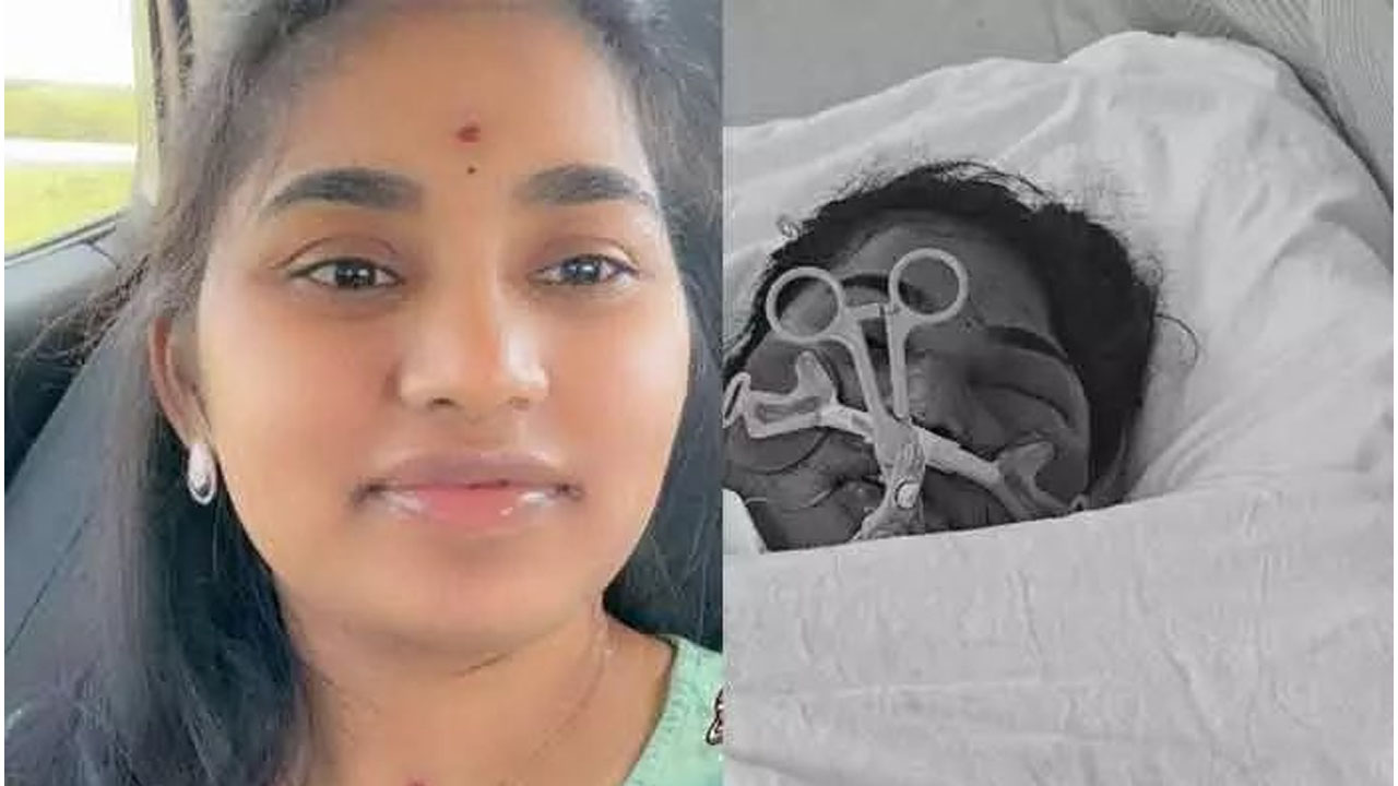 Road Accident | అమెరికాలో జరిగిన రోడ్డు ప్రమాదంలో ఏపీకి చెందిన యువతి మృతి