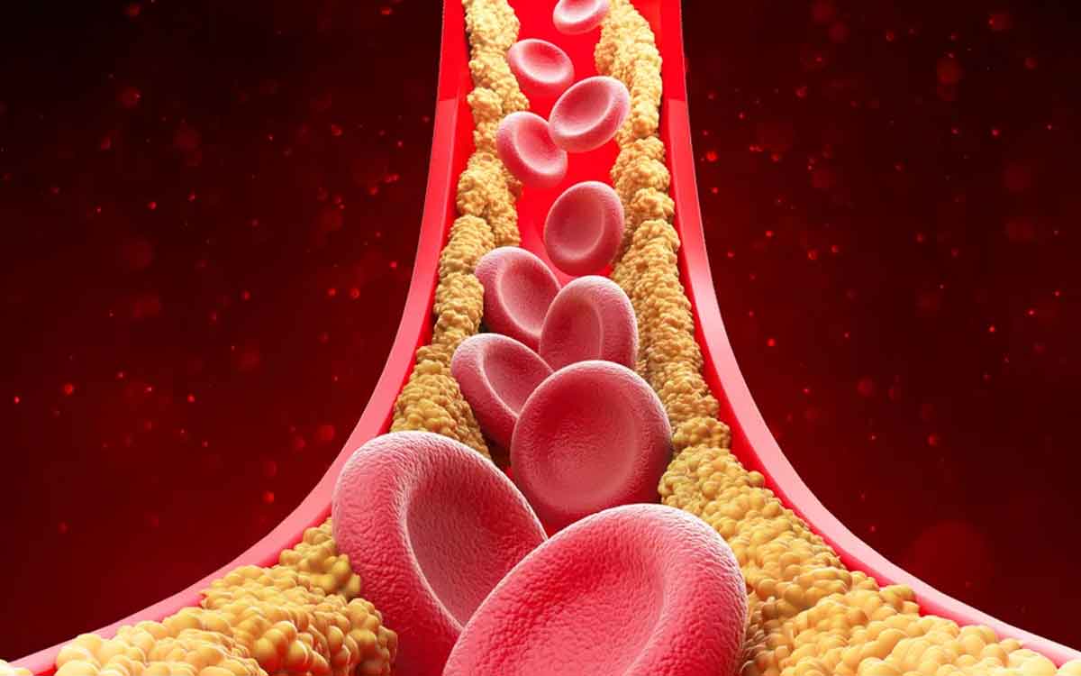 Cholesterol | గుండె జ‌బ్బులు వ‌చ్చేందుకు కేవ‌లం కొలెస్ట్రాల్ ఒక్క‌టే కార‌ణం కాదు.. ఇవి కూడా కార‌ణాలే..