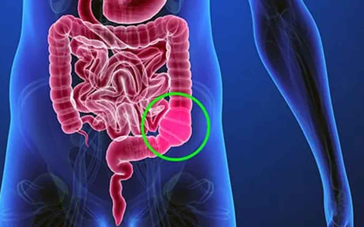 Constipation | మ‌ల‌విసర్జ‌న స‌మ‌స్య ఉన్న‌వారికి ప‌నికొచ్చే ఉప‌యోగ‌క‌ర‌మైన చిట్కాలు ఇవి.. ఏం చేయాలంటే..