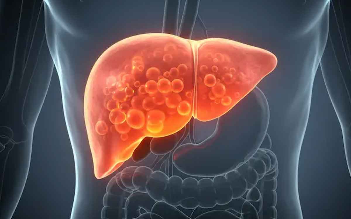 Fatty Liver | ఫ్యాటీ లివ‌ర్ స‌మ‌స్య‌ను త‌గ్గించ‌డంలో ఎంతో మేలు చేసే జీల‌క‌ర్ర‌.. అధ్య‌య‌నంలో వెల్ల‌డి..