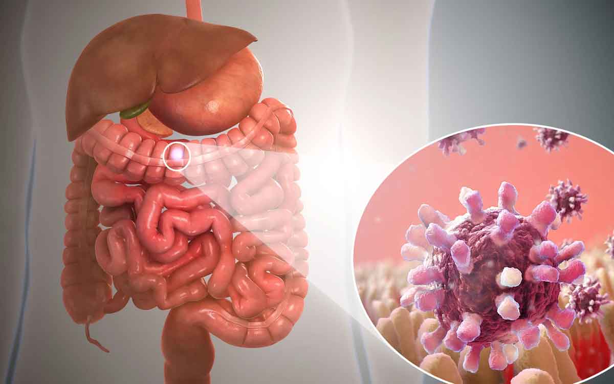 Gastroenteritis | గ్యాస్ట్రో ఎంట‌రైటిస్‌, ఫుడ్ పాయిజ‌నింగ్‌ల మ‌ధ్య తేడాలేమిటి.. ల‌క్ష‌ణాలు ఎలా ఉంటాయి.. ఏం చేయాలి..?