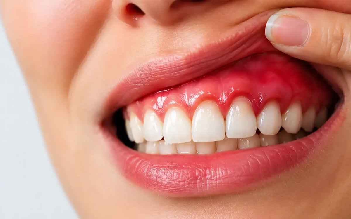 Gums Health | నోట్లో ఈ ల‌క్ష‌ణాలు త‌ర‌చూ క‌నిపిస్తే జాగ్ర‌త్త‌.. ఇత‌ర అవ‌య‌వాల‌పై ప్ర‌భావం ప‌డుతుంది..