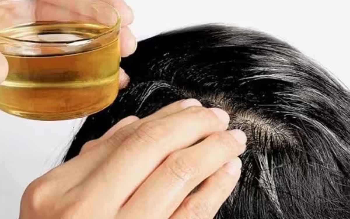 Hair Oil | జుట్టుకు నూనె రాస్తున్నారా.. ఈ ముఖ్య‌మైన విష‌యాల‌ను తెలుసుకోవ‌డం త‌ప్ప‌నిస‌రి..
