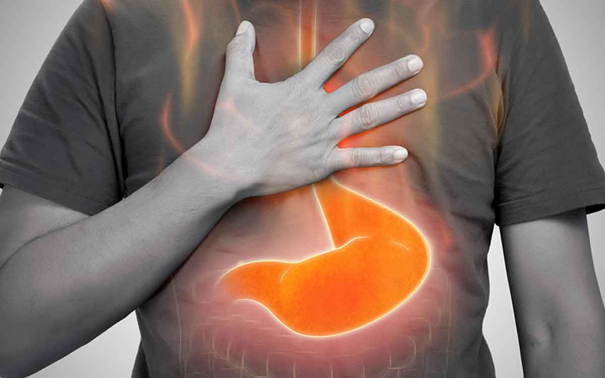 Heart Burn | హార్ట్ బ‌ర్న్ లేదా యాసిడ్ రిఫ్ల‌క్స్ అంటే ఏమిటి.. త‌గ్గేందుకు ఏం చేయాలి..?