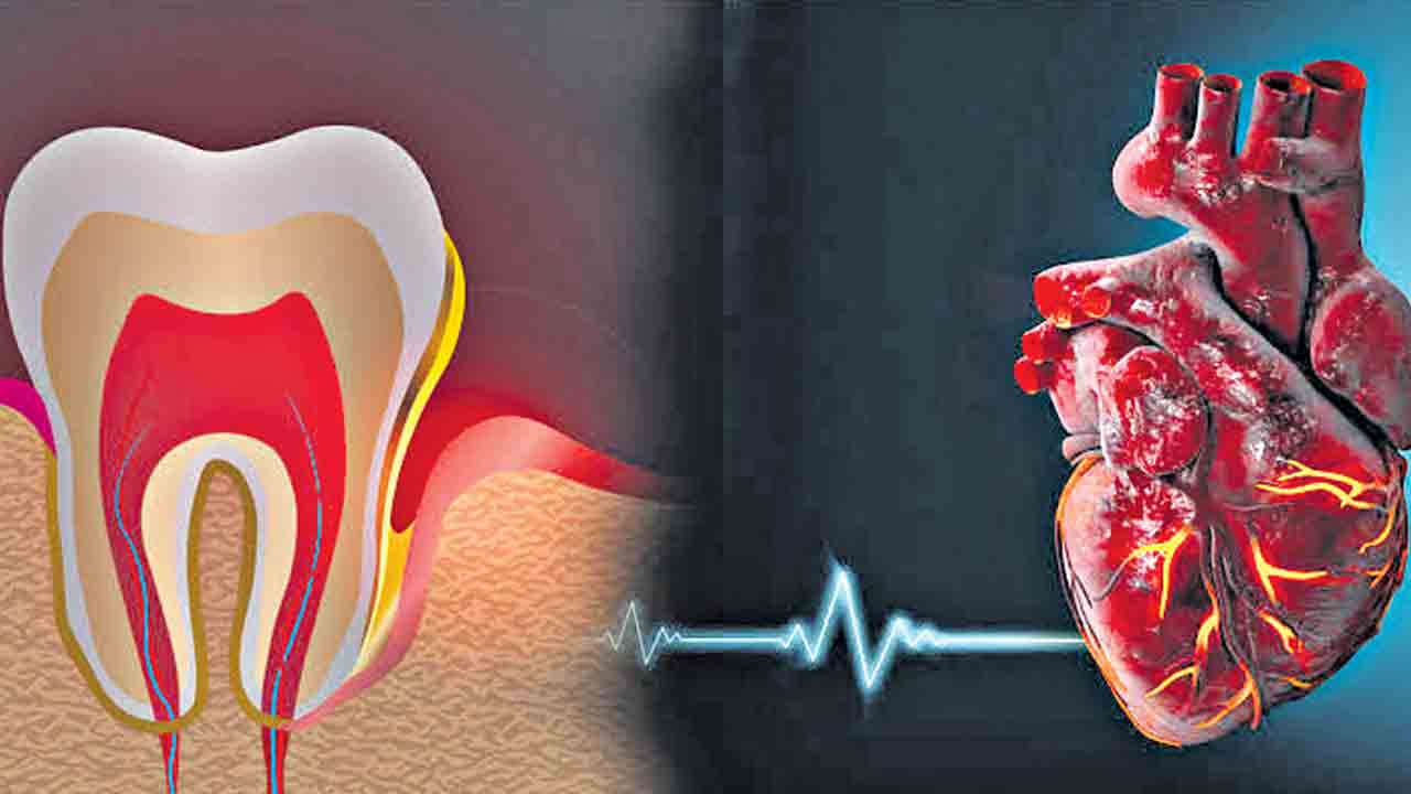 చిగుళ్ల సమస్య గుండెదాకా..