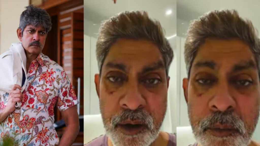 Jagapathi Babu | “ఎవ్వరూ నా మొహం పగలగొట్టలేదు”.. ముఖంపై గాయాలపై జగపతి బాబు క్లారిటీ