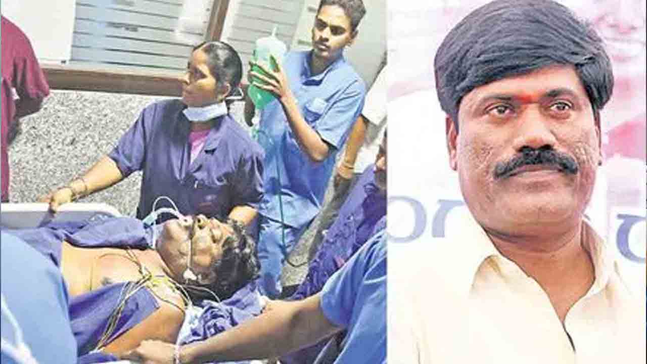 Peddi Sudarshan Reddy | వెంటిలేటర్‌పైనే పెద్ది సుదర్శన్ రెడ్డి.. హెల్త్ బులెటిన్ విడుదల..!