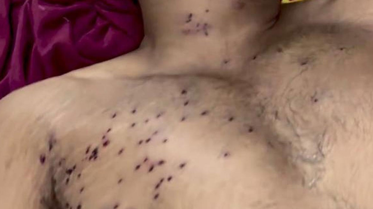 Pellet Guns: సీజేపీ నిర‌స‌న‌కారుడికి గాయాలు.. పెల్లెట్ గ‌న్స్ వాడ‌కంపై సీఆర్పీఎఫ్ ద‌ర్యాప్తు