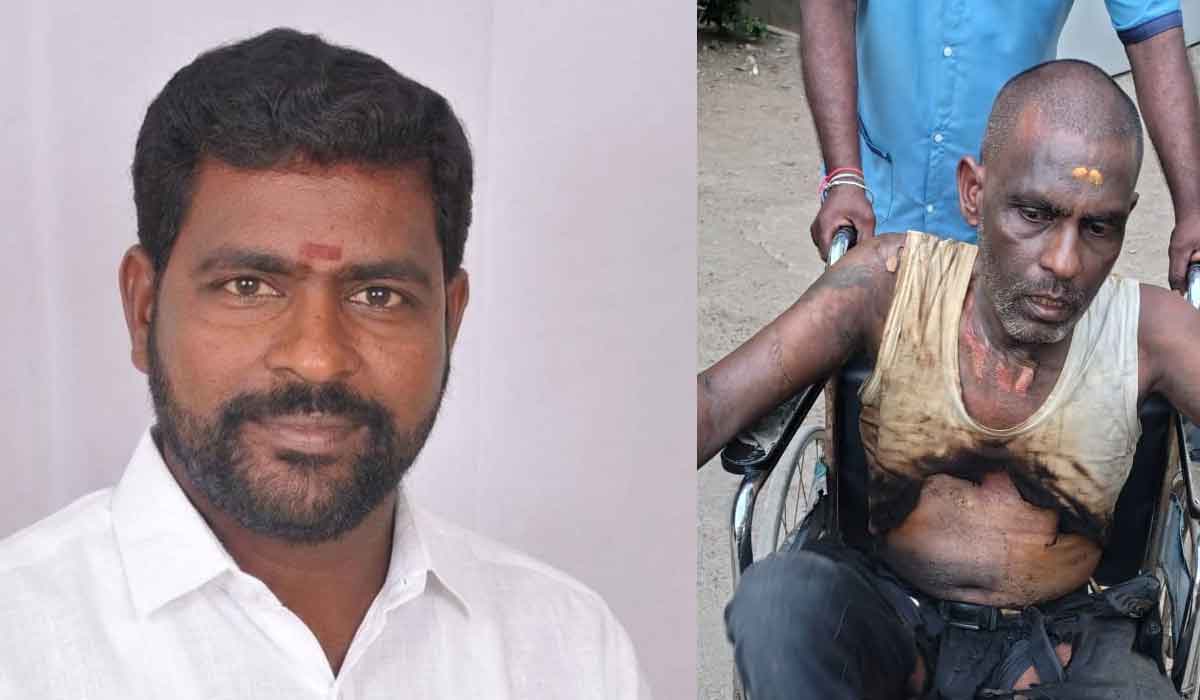 Gundlapalli | చికిత్స పొందుతూ గుండ్లపల్లి మాజీ సర్పంచ్‌ భర్త మృతి