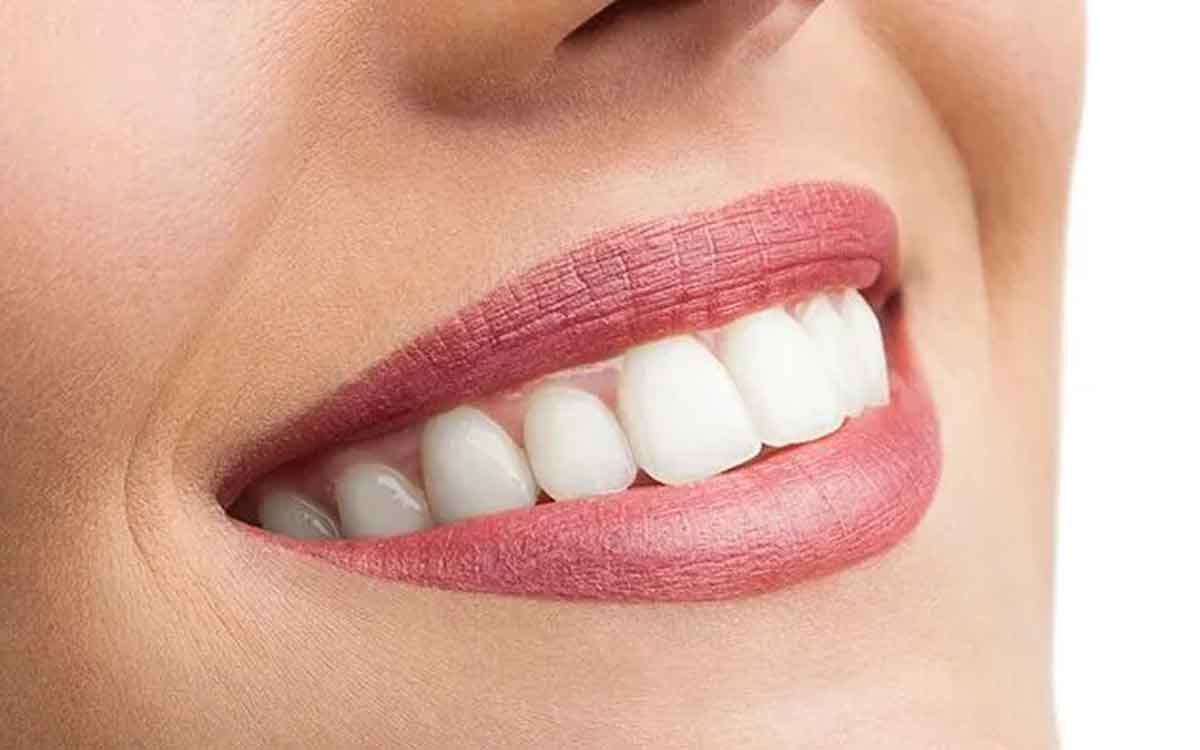 Teeth Whitening | సోష‌ల్ మీడియాలో ప్ర‌చారంలో ఉన్న చిట్కాలు దంతాల‌ను తెల్ల‌గా మారుస్తాయా.. నిపుణులు ఏమంటున్నారు..
