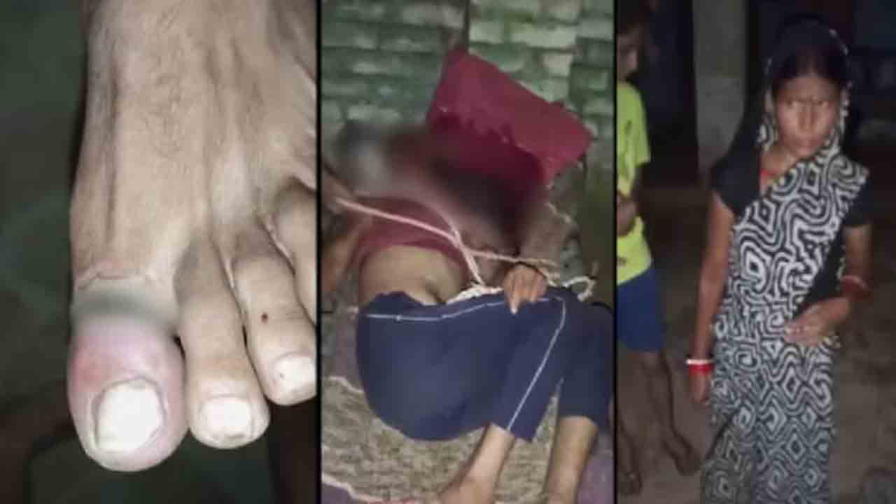 woman ties husband to cot, beats | భర్తను మంచానికి కట్టేసి కొట్టి.. విద్యుత్ షాక్‌లు ఇచ్చిన భార్య