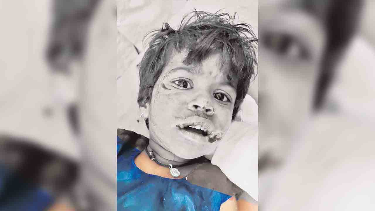 బాన్సువాడలో మరోసారి వీధి కుక్కల బీభత్సం