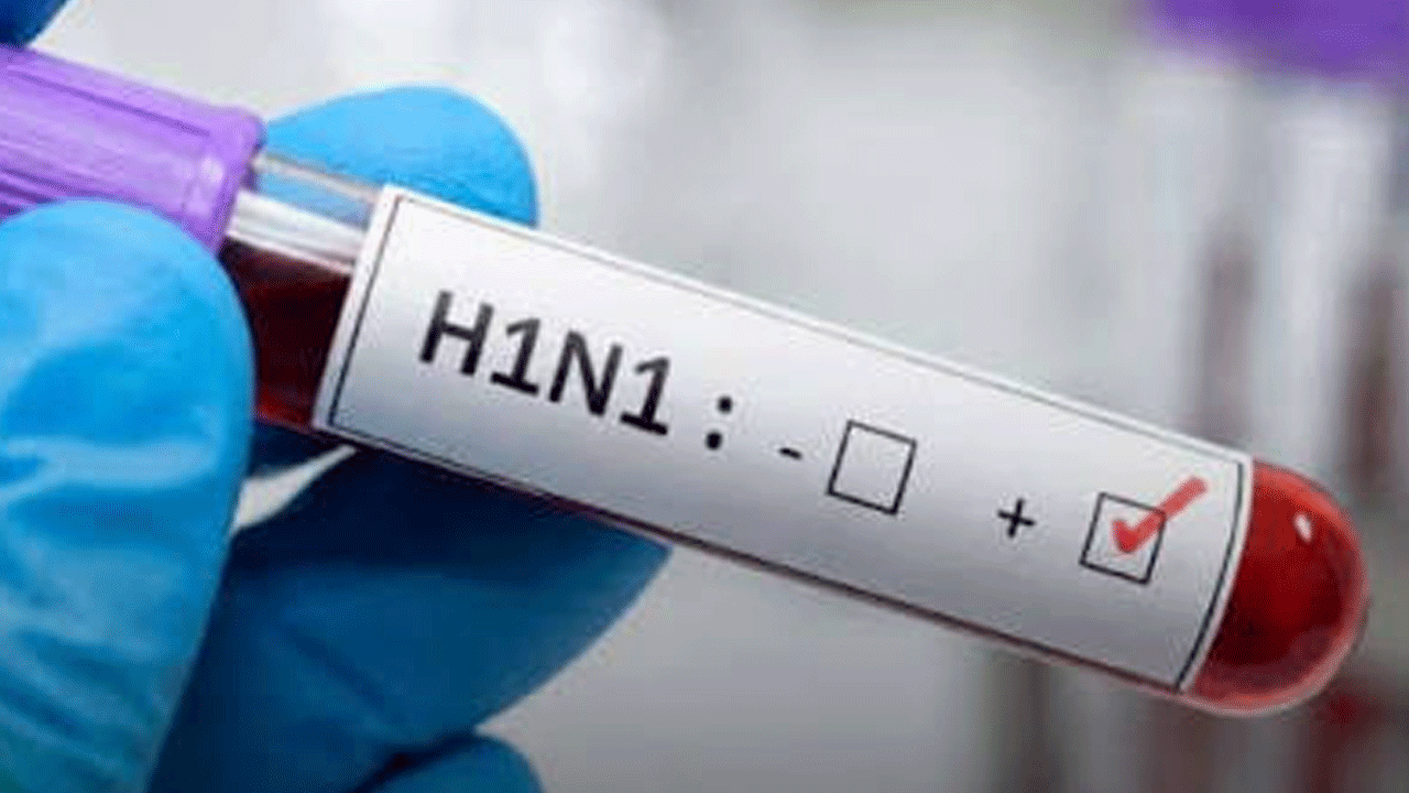 Swine flu | ఢిల్లీ, బెంగ‌ళూరులో వేగంగా పెరుగుతున్న స్వైన్ ఫ్లూ కేసులు