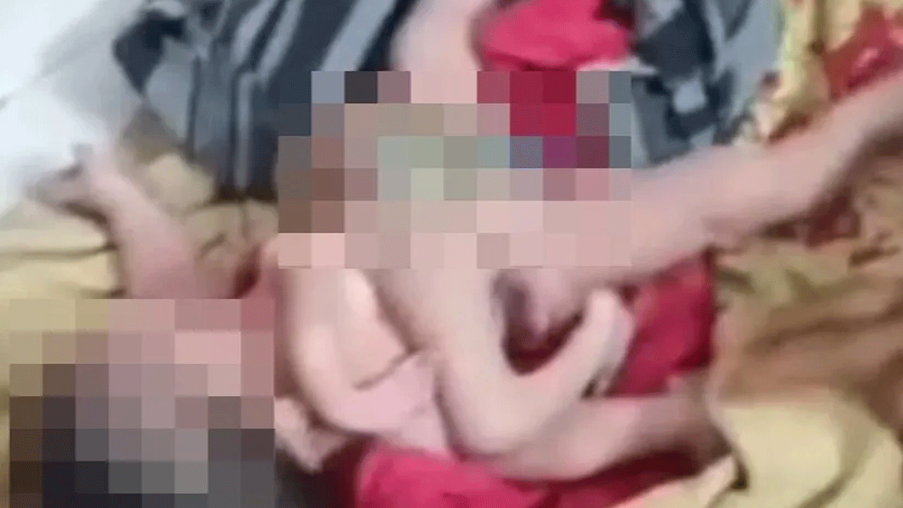 Viral news | మ‌ధ్య‌ప్ర‌దేశ్‌లో వింత‌శిశువు జ‌న‌నం.. నాలుగు కాళ్లు, నాలుగు చేతులు..!