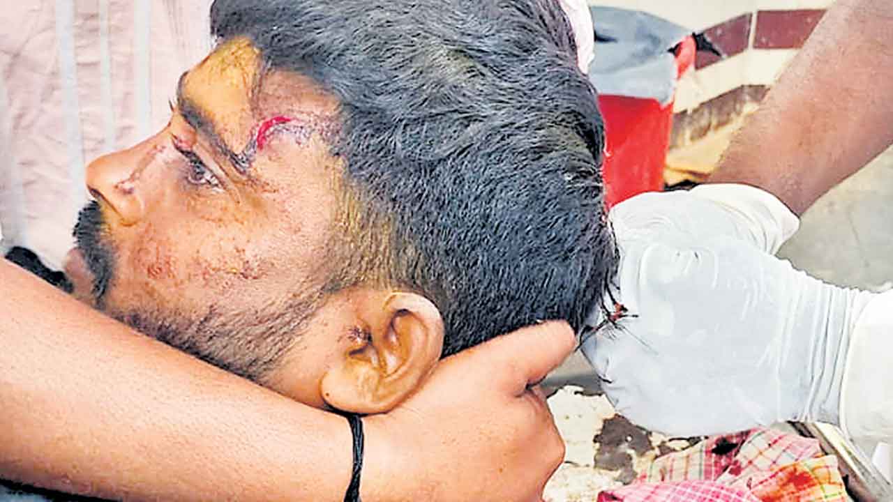 బీఆర్‌ఎస్‌ కార్యకర్తలపై కాంగ్రెస్‌ గూండాల దాడి