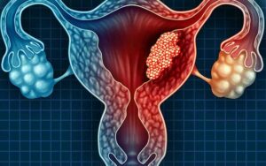 Endometrium