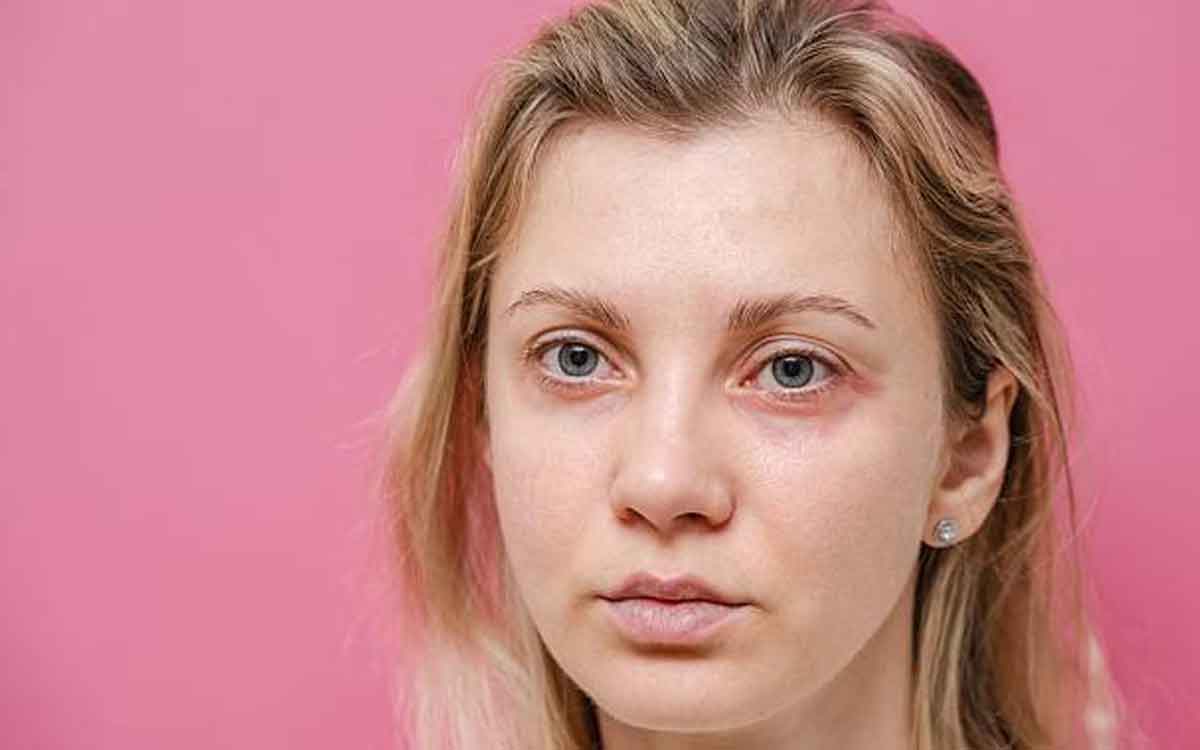 Facial Signs | ముఖంపై ఇలాంటి ల‌క్ష‌ణాలు, సంకేతాలు క‌నిపిస్తున్నాయా.. అయితే జాగ్ర‌త్త‌..