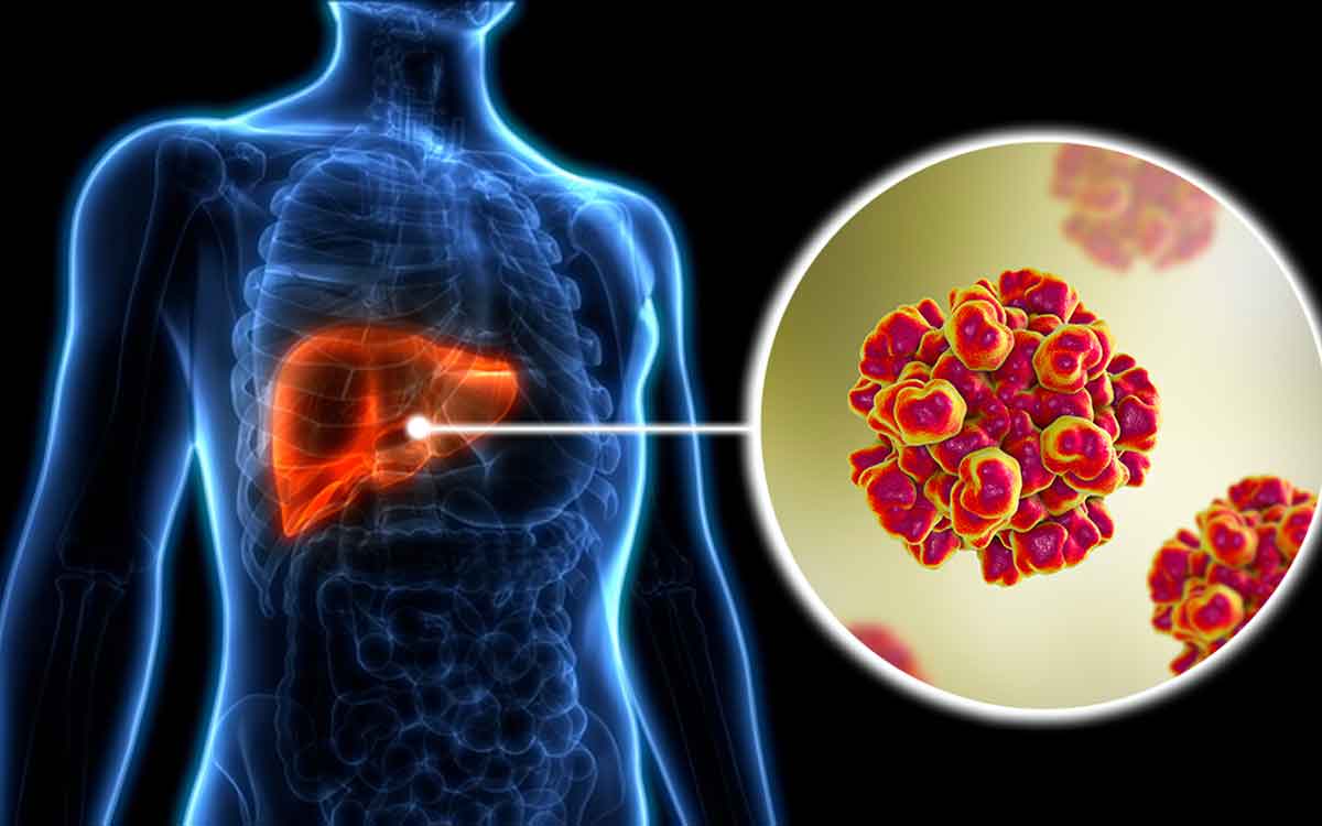 Hepatitis | యువ‌త‌లో పెరుగుతున్న హెప‌టైటిస్ ముప్పు.. ఆందోళ‌న వ్య‌క్తం చేస్తున్న నిపుణులు..