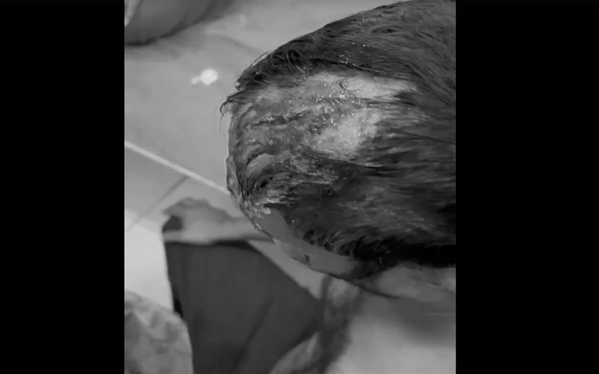 తమ్ముడిపై అన్న హత్యాయత్నం