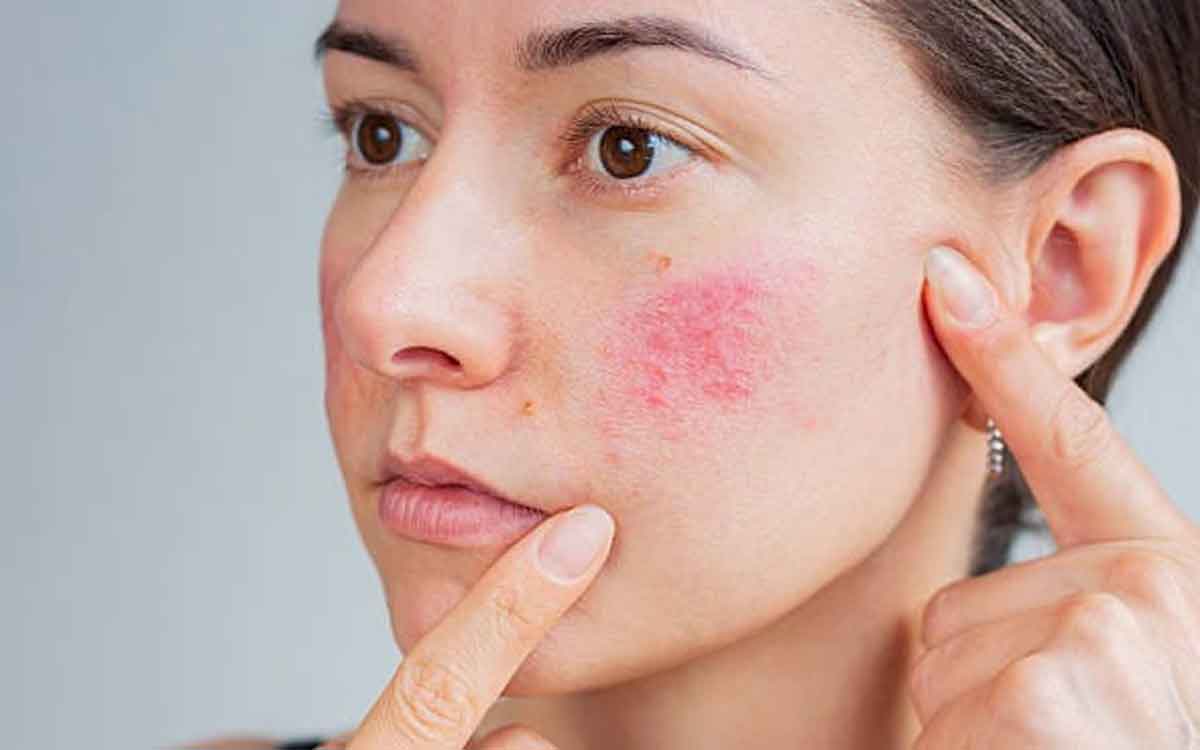 Skin Care Products | చ‌ర్మ సంర‌క్ష‌ణ ఉత్ప‌త్తుల‌ను త‌ర‌చూ వాడుతున్నారా.. అయితే ఎలాంటి స‌మ‌స్య‌లు వ‌స్తాయంటే..?