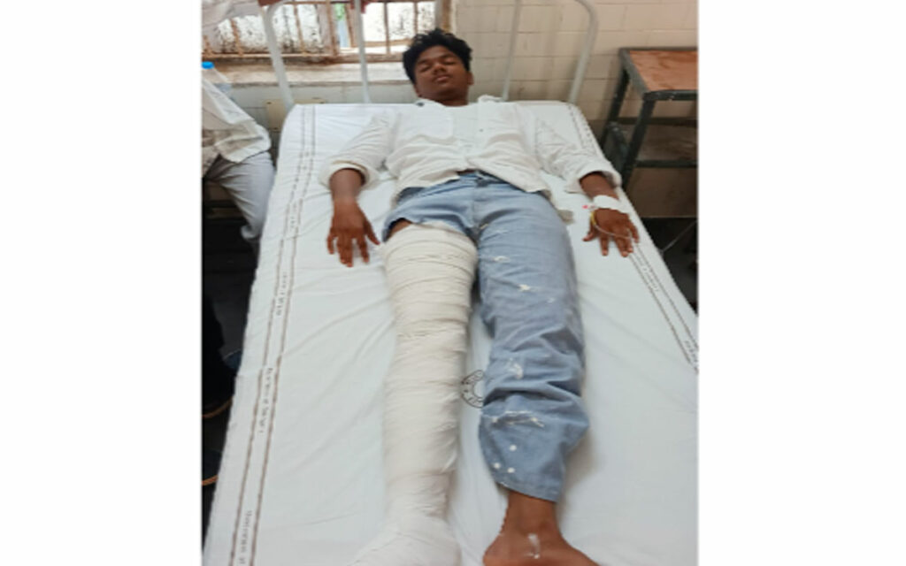 ఎంజీయూలో మద్యం మత్తులో డ్రైవర్ బీభత్సం.. విద్యార్థికి విరిగిన కాలు