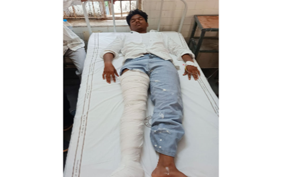 ఎంజీయూలో మద్యం మత్తులో డ్రైవ‌ర్ బీభ‌త్సం.. విద్యార్థికి విరిగిన కాలు