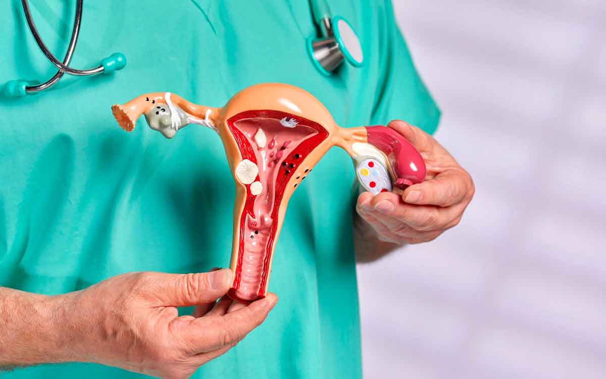 Ovarian Cancer | అండాశ‌య క్యాన్స‌ర్ వంశ‌పారంప‌ర్యంగా వ‌స్తుందా.. ఎలాంటి ల‌క్ష‌ణాలు క‌నిపిస్తాయి..?