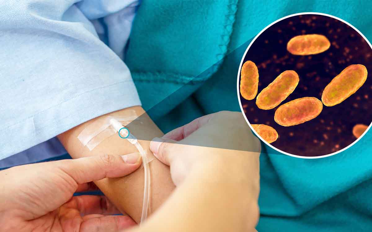 Sepsis | సెప్సిస్ అంటే ఏమిటి.. ఎలాంటి ల‌క్ష‌ణాలు క‌నిపిస్తాయి.. దీంతో ఏమ‌వుతుంది..?