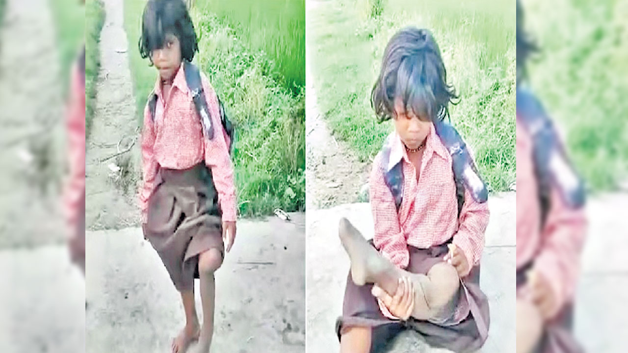 ఒంటికాలితో కుంటుతూ పాఠశాలకు