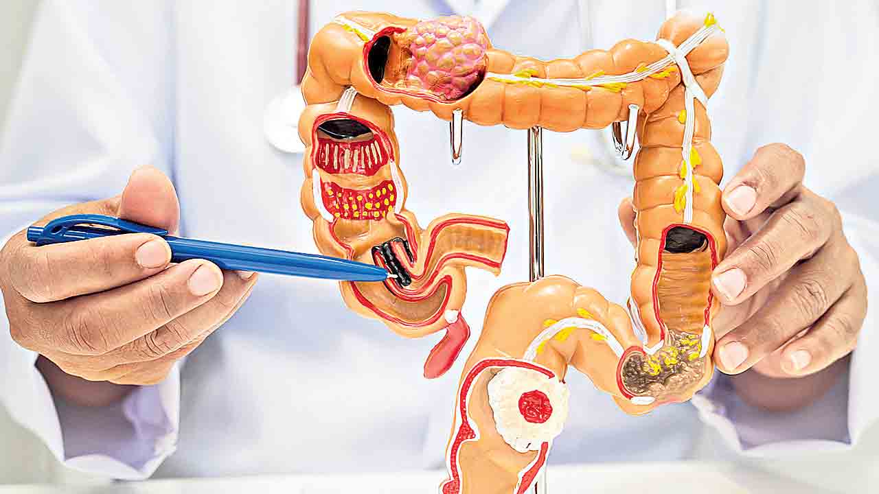 ముందస్తు స్క్రీనింగ్‌తో ముప్పును తప్పించుకోవచ్చు!