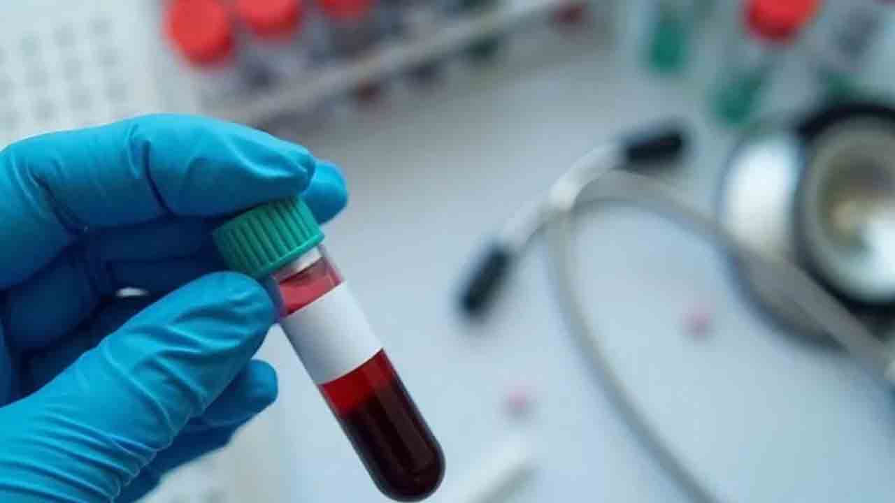 రక్త పరీక్షలు చేయట్లే..!