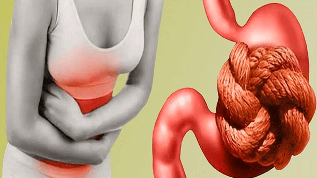 Health tips | అజీర్తి సమస్య అవస్థ పెడుతోందా.. అయితే ఈ చిట్కాలు మీ కోసమే..!
