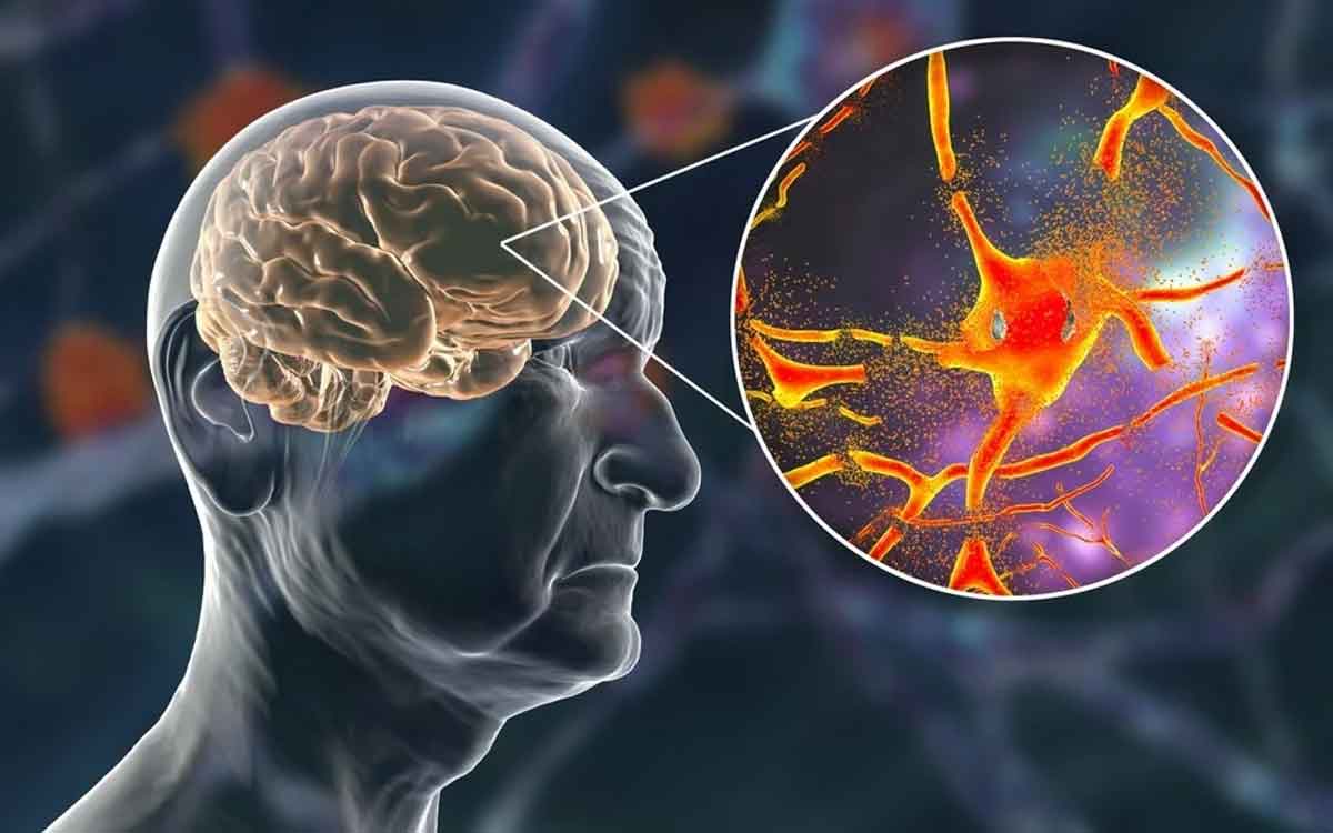 Ageing | వ‌య‌స్సు పెరుగుతున్న‌కొద్దీ మెద‌డును ఆరోగ్యంగా ఉంచుకోవాలి.. ఎందుకంటే..