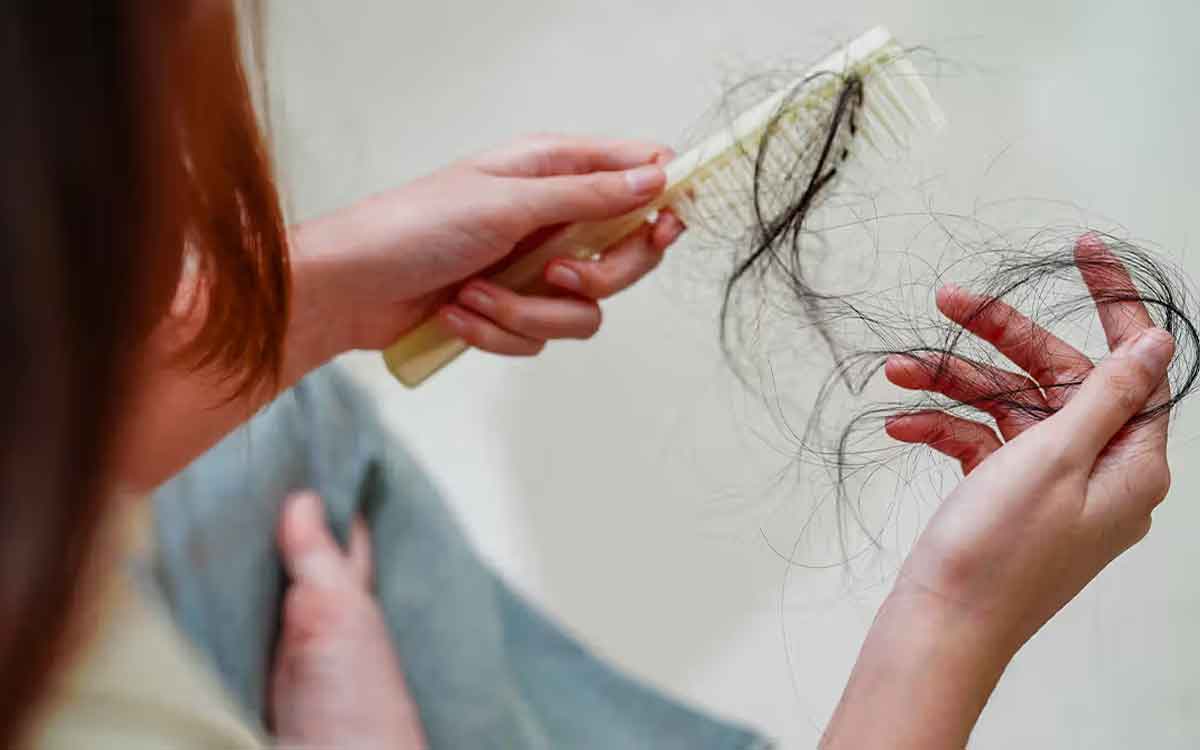 Hair Fall | జుట్టు రాల‌డానికి వారం క్రితం వ‌చ్చిన మార్పులే కార‌ణ‌మా.. నిపుణులు ఏమంటున్నారు..?