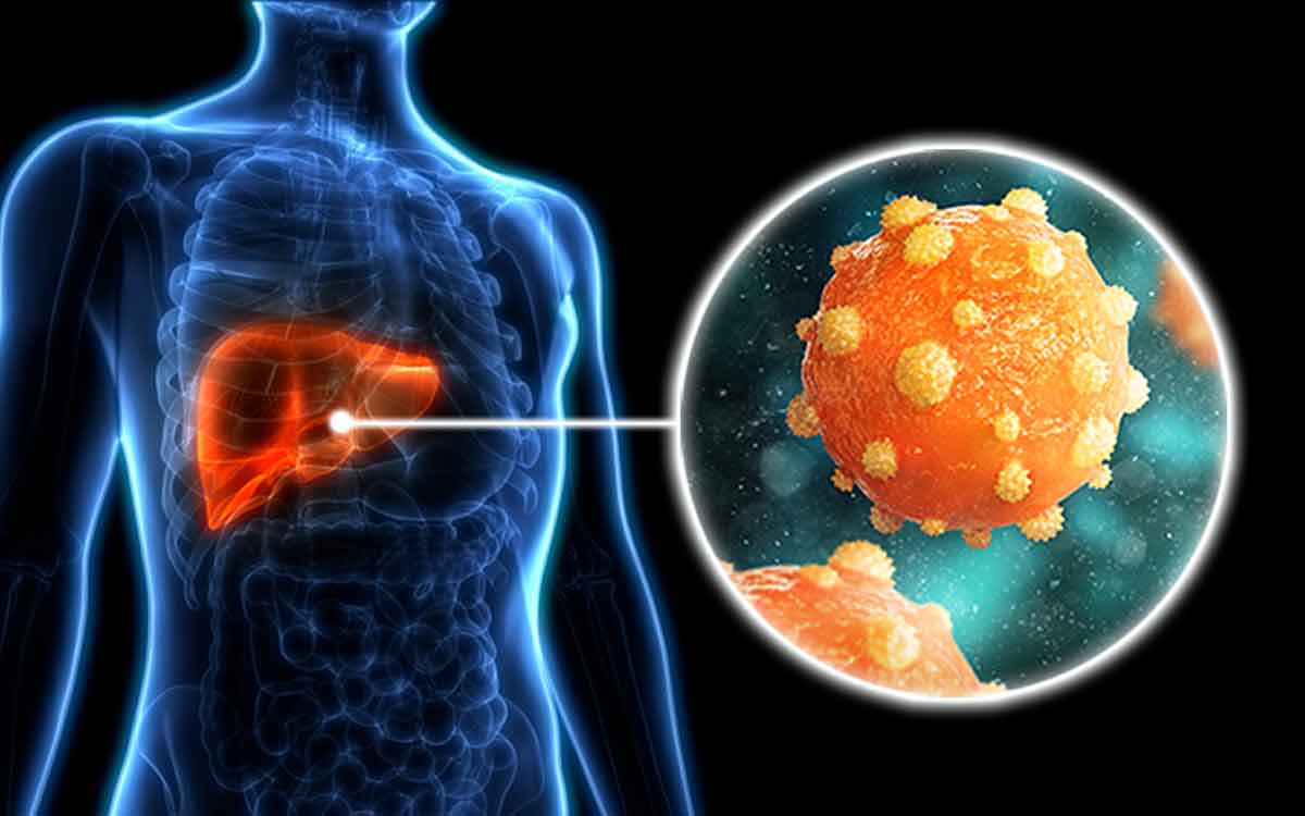 Hepatitis B | హెప‌టైటిస్ బి వ్యాధిగ్ర‌స్తుల‌కు కొత్త ఔష‌ధం.. ఆమోదం తెలిపిన అమెరికా ఎఫ్‌డీఏ..