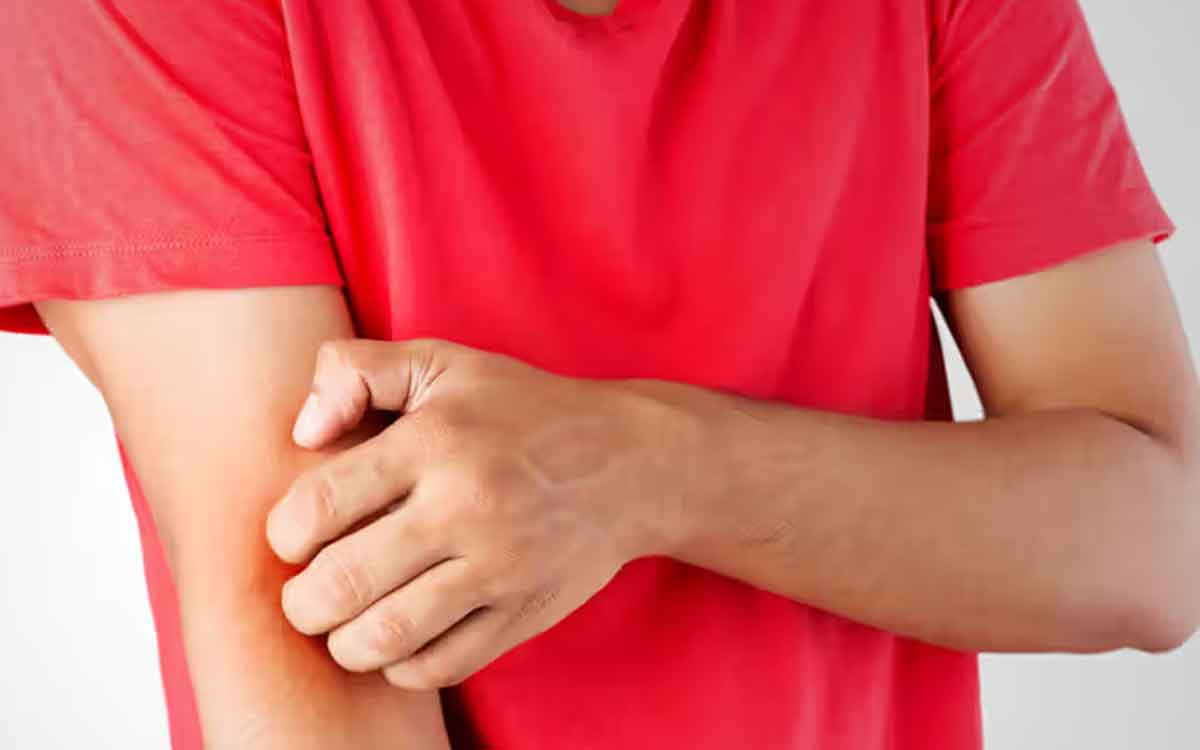 Infections | శ‌రీరంలో ఇన్ఫెక్ష‌న్లు తీవ్ర‌మైతే క‌నిపించే ల‌క్షణాలు ఇవే.. వీటితో జాగ్ర‌త్త‌..