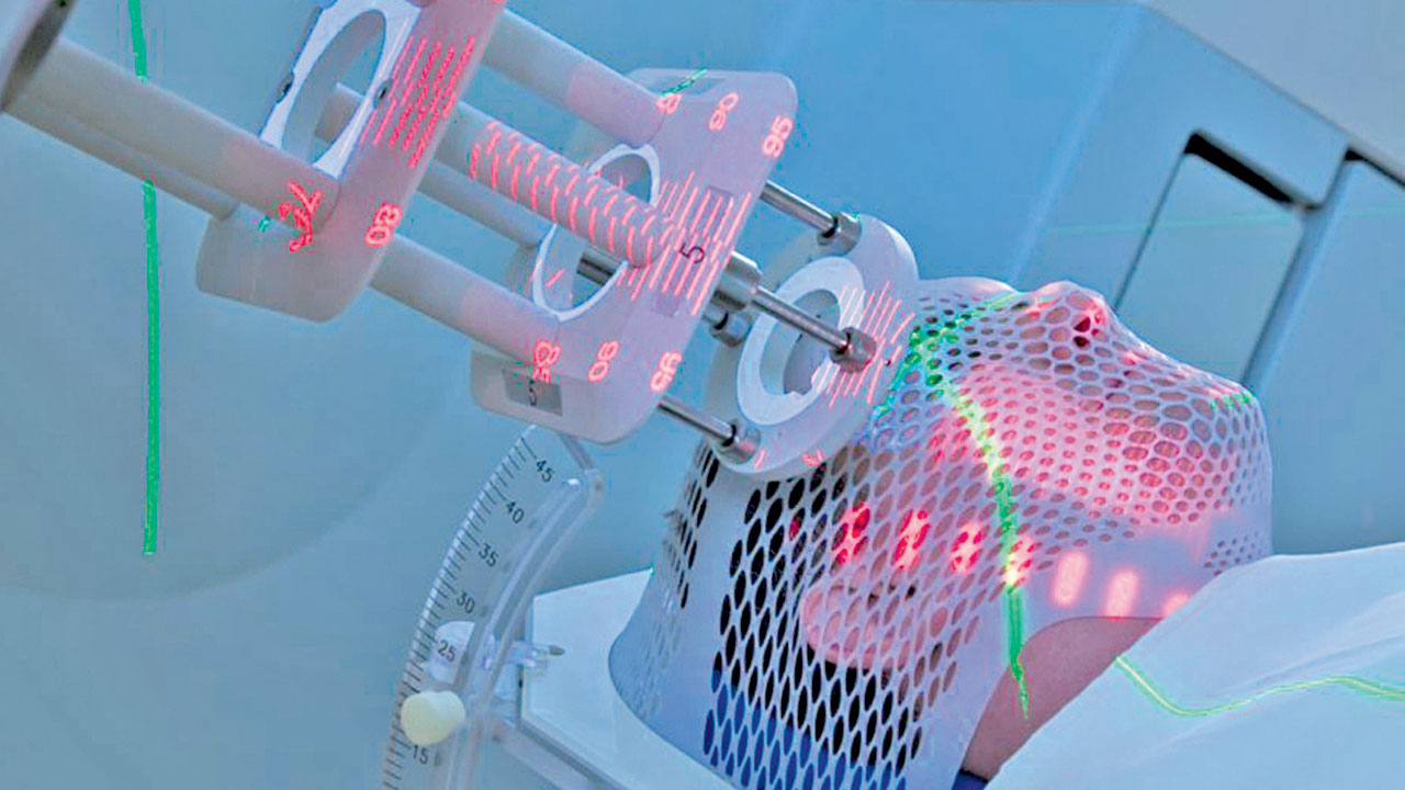 Radiation Therapy